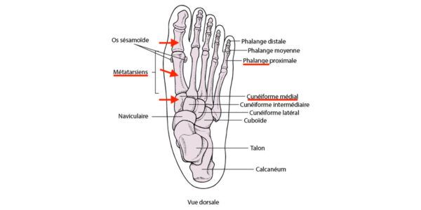 Parcourez notre article sur l'oignon au pied et la déformation chez Kinatex Sports Physio, Québec et Ontario.