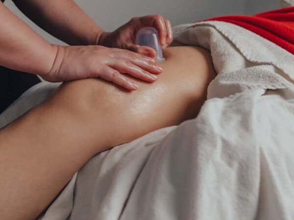 Vacuothérapie : tout savoir sur le massage aux ventouses