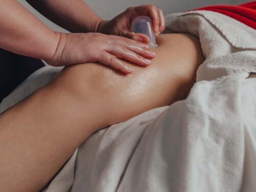 Le massage aux ventouses pour soulager les tensions musculaires chez Kinatex Sports Physio, Québec et Ontario.